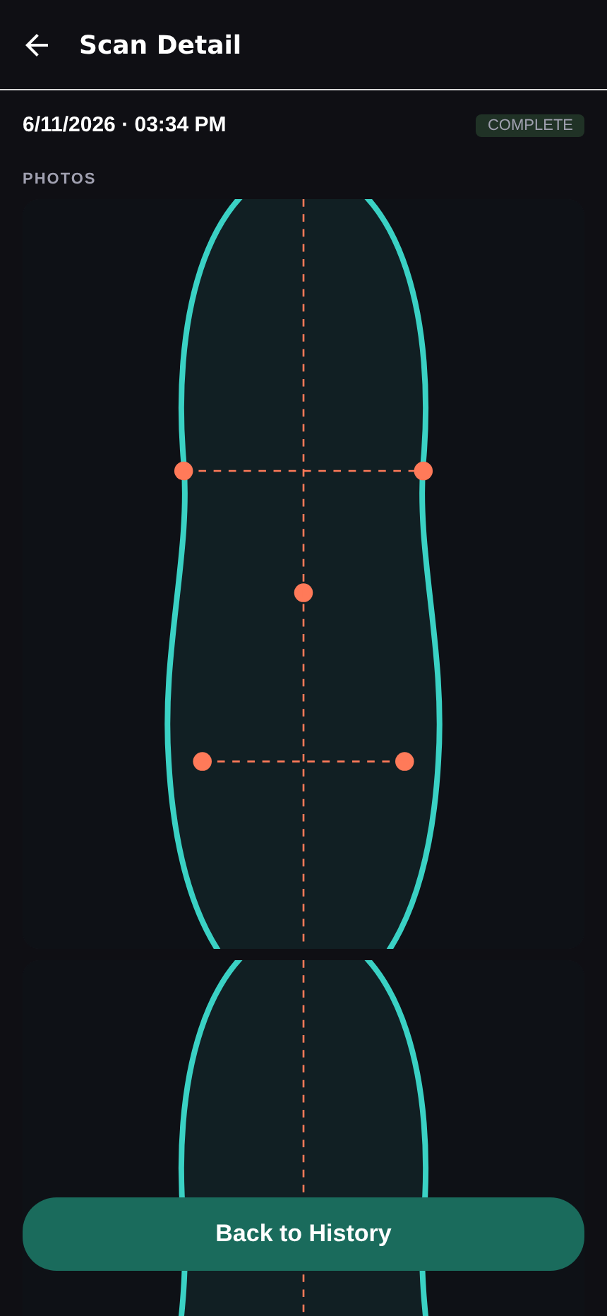 FOOTSCAN — scan detail with traced sole outline and measurement landmarks